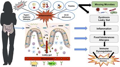 Frontiers | Role Of Vitamin D In The Hygiene Hypothesis: The Interplay ...